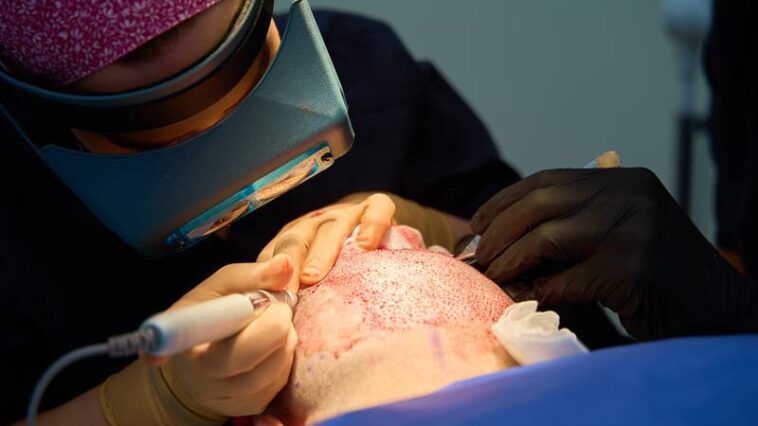 Die Türkei steht für günstige Haartransplantationen