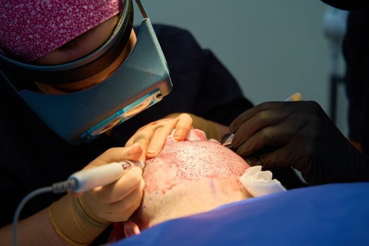 Die Türkei steht für günstige Haartransplantationen